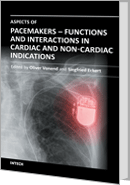 Aspects of Pacemakers - Functions and Interactions in Cardiac and Non-Cardiac Indications